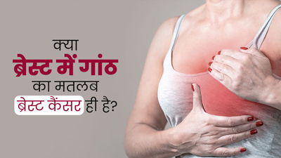 क्या स्तन में गांठ होना हमेशा ब्रेस्ट कैंसर का संकेत होता है? डॉक्टर से जानें कैसे करें पहचान